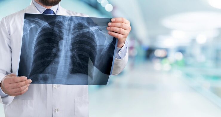 Imaging for Bipolar Hip Hemiarthroplasty